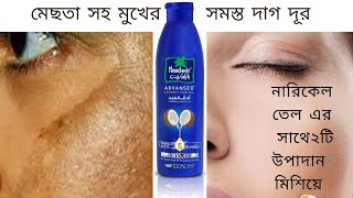 মুখের মেছতা সহ যেকোন দাগ দূর করতে নারিকেল তেল এর আরো ২টি উপাদান মিশিয়ে লাগান/মেছতা দূর করা screenshot 2