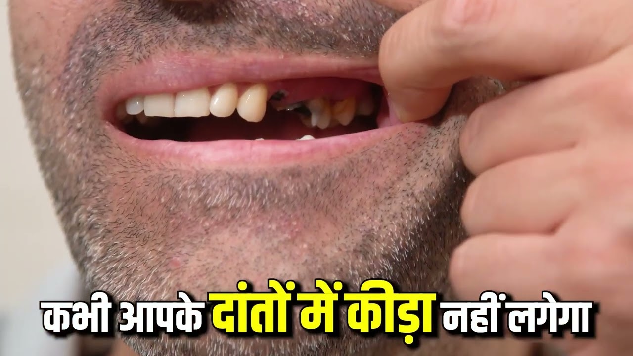 How to Cure Acidity and Throat Discomfort Naturally | Acharya Manish Ji