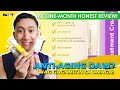 HOW TO USE: Retinol + Bakuchiol | ONE-MONTH of Using! | Luxe Organix | Philippines | Dan TV
