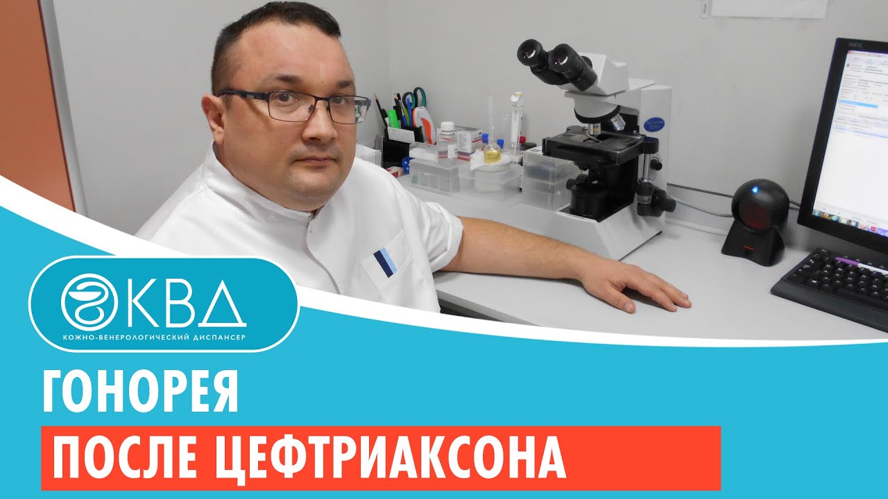 😲 Гонорея после цефтриаксона. Клинический случай №827