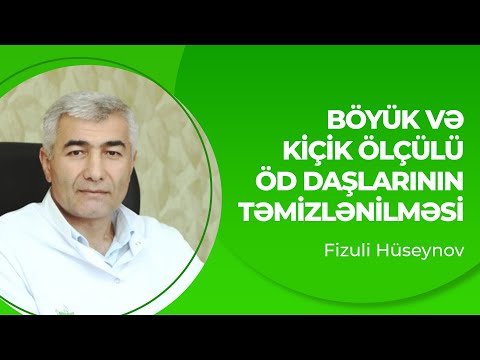 Böyük və kiçik ölçülü öd daşlarının təmizlənilməsi | Öd daşlarının təbii müalicəsi | Fizuli Hüseynov