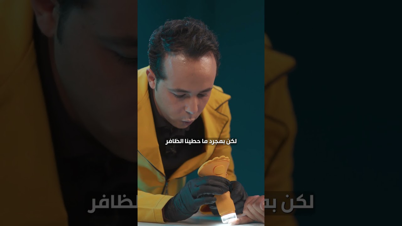 ⁣لو فاكر إن ضوافرك نضيفة؟استنى لما تشوفها تحت الميكروسكوب😳