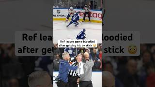 Celebrity Referee Chris Rooney had to leave Game 7 after taking a stick to the face (pause) 🏒😖 #nhl #hockey Profile