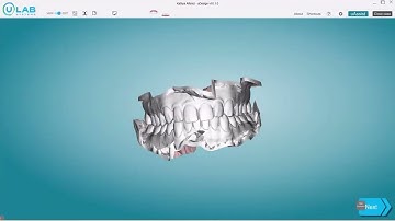 uDesign 10 - Submit a Refinement on a Self Planned Case