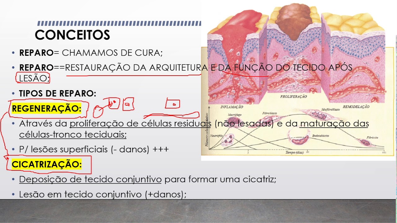 Patologia Geral - Reparo Tecidual/Celular
