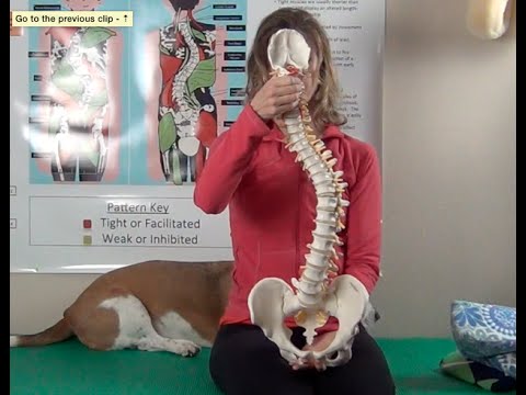 What Scoliosis C And S Curve