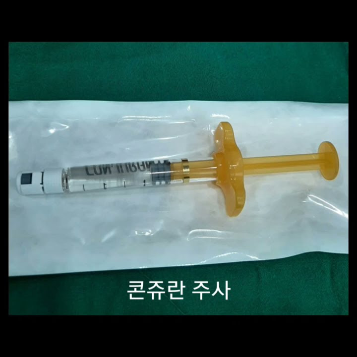 S5 무릎 통증에 대한 콘쥬란주사와 인대 프롤로치료