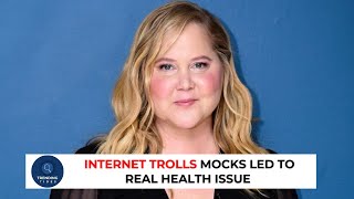 Comedian Amy Schumer is crediting internet trolls Moon Face Mocks Led to Real Health Issue