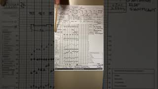 Anesthesia record - 2020