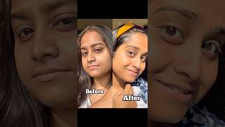 AHA BHA Peeling Solution for Tan Removal 😳 Instant Glow Hack!