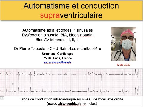 Vidéo: Bloc Cardiaque (Mobitz Type I) Chez Les Chats