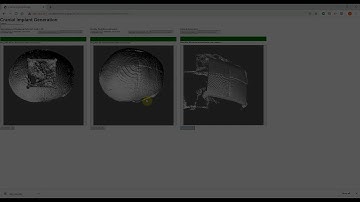 Cloud-based Cranial Defect Reconstruction for medical 3D Printing