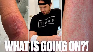 POST SURGERY EMERGENCY | FEARING INFECTION AND SEVERE ALLERGIC REACTION AFTER SURGERY ON RIGHT ARM