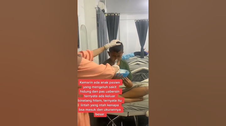 lintah besar dalam hidung #sakit #viral #shorts