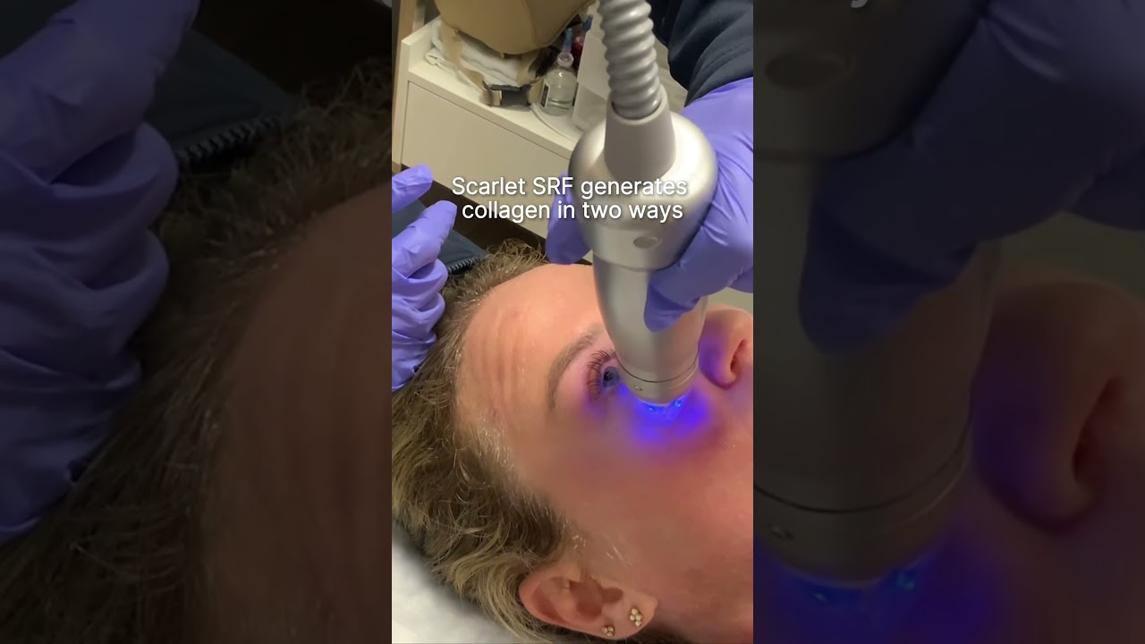 How Scarlet SRF Builds Firmer, Healthier Skin