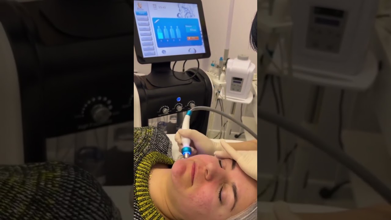 Eleminimi i pikave të zeza ma Hydrafacial