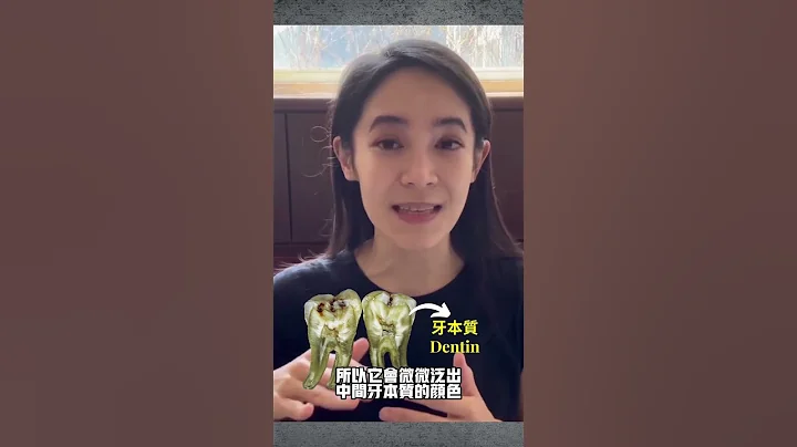黄板牙真正原因。牙齿美白选什么好#瓷贴片＃冷光美白＃美白贴片 - 天天要闻