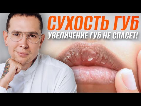 Как избавиться от СУХОСТИ ГУБ #сухостьгуб