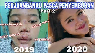PERJUANGANKU UNTUK SEMBUH SETELAH KECELAKAAN (Part 2) // Pengalaman yang sangat berarti -YunikaAjeng