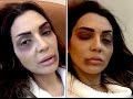 شاهد ماذا حصل للفنانه عبير احمد في كواليس مسلسل الكالوس