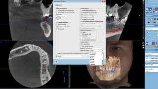 Exporting a 3D Volume with Planmeca Romexis© Viewer
