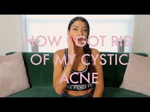 Clear Skin from within! How i cured my Cystic Acne and how you can too!