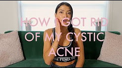 Clear Skin from within! How i cured my Cystic Acne and how you can too!