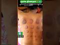 மூச்சு திணறல் ⁉️💧 #shorts #viral #trending #health #asthma #wheezing #naturopathy #tamil