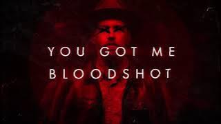 Sam Tinnesz - Bloodshot [ Lyric Video]