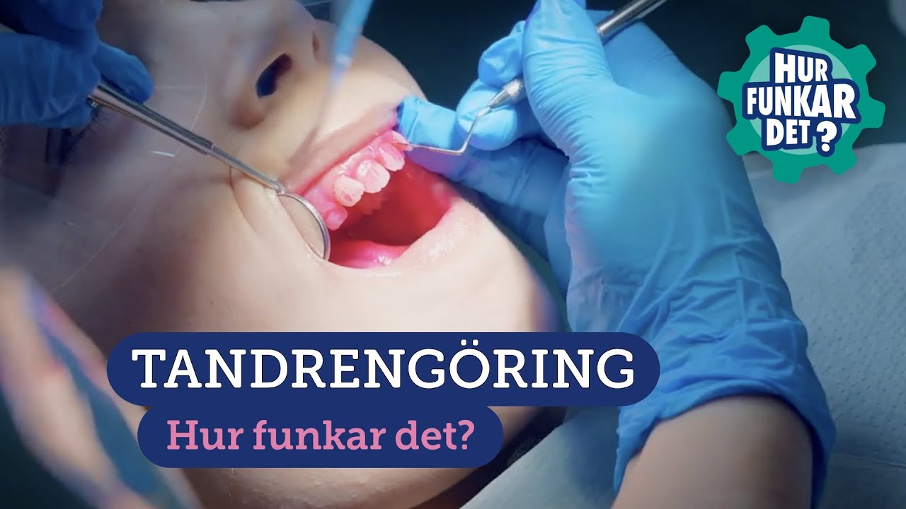 Tandrengöring hos tandhygienist