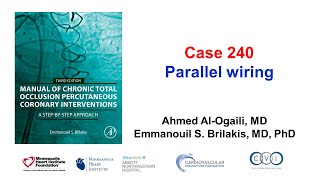 Case 240: Manual of CTO PCI - Parallel wiring