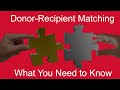 Donorrecipient matching what you need to know