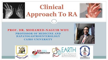 Clinical Approach To A Case Of Rheumatoid Arthritis - Prof. Mohamed-Naguib Wifi