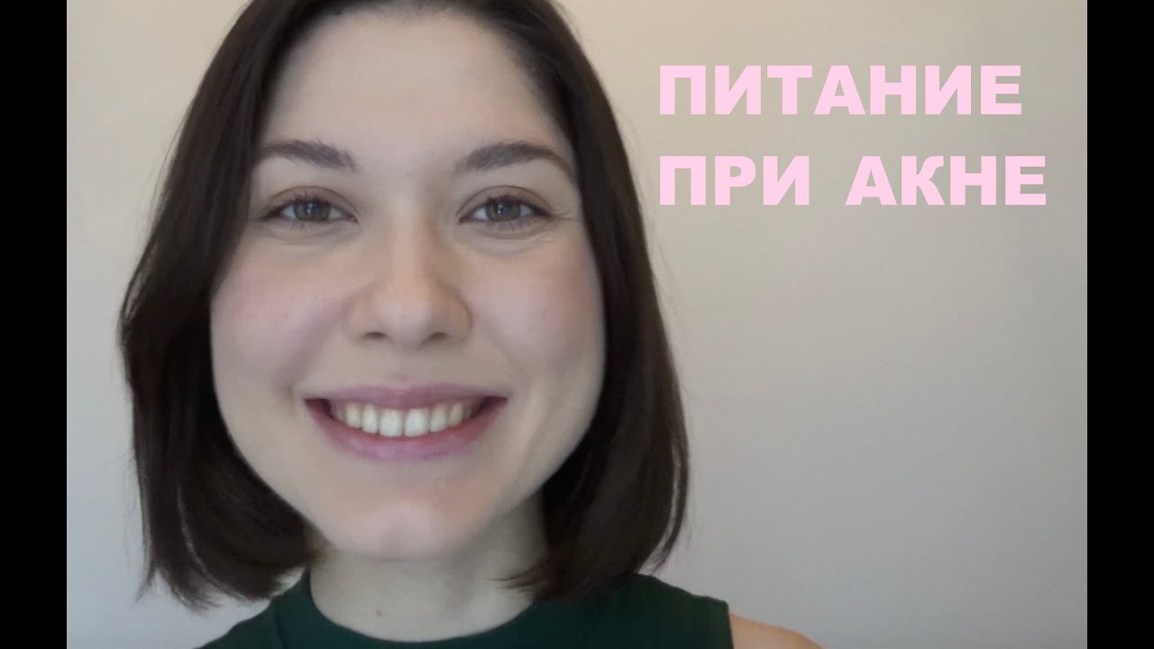 Продукты питания, которые помогут избавиться от акне | Как избавиться от прыщей
