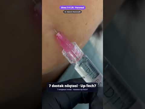 Dives 7-V Lift — üz ovalının liftinqi