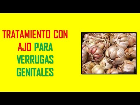 como eliminar verrugas genitales natural