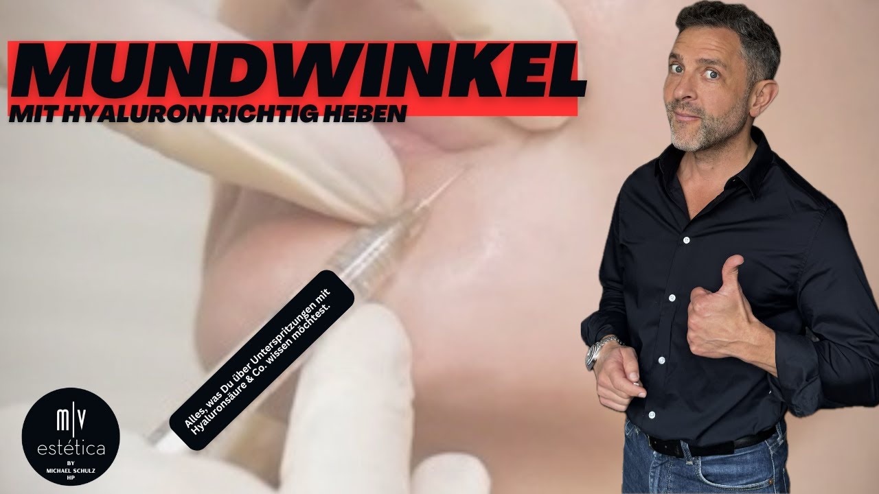 Wie hebe ich die Mundwinkel mit Hyaluronsäure?