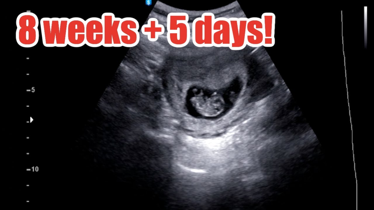 Ultrasound showing baby at 8 weeks + 5 days! - YouTube
