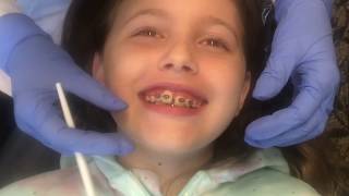 6th Braces Visit || Getting Braces Tightened 🎃