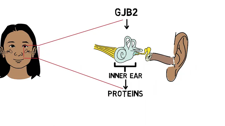 Genetics of hearing loss