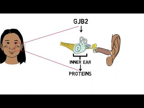 Genetics of hearing loss