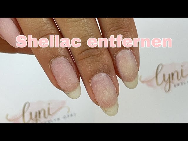 Shellac ablsen mit Remover | Gellack entfernen