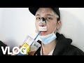 Getting Rhinoplasty in Gangnam || Vlog - Edward Avila