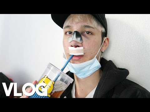 getting-rhinoplasty-in-gangnam-||-vlog---edward-avila