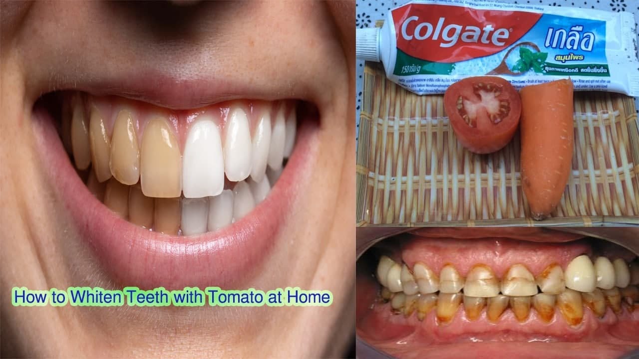 How To Whiten Your Yellow Teeth Naturally / Teeth Whitening At Home In 3 Minutes With Carrot