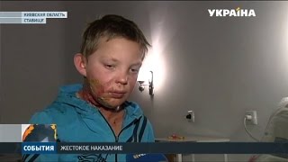 В Киевской области отчим залил пасынку в рот спирт и поджёг В Киевской области отчим залил пасынку в рот спирт и поджёг