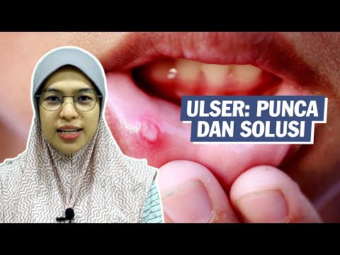 Video: Kudis Pada Bibir: Sebab, Rawatan, Dan Masa Pemulihan