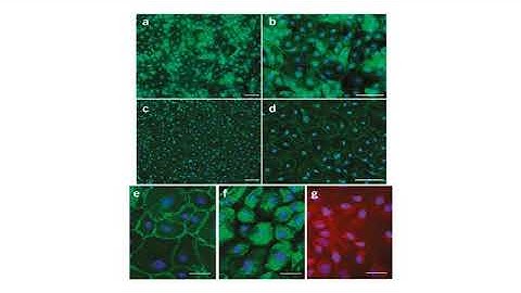 human brain microvascular endothelial cells