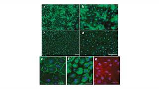 human brain microvascular endothelial cells