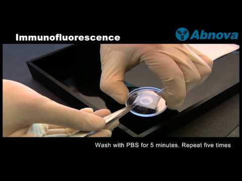 Video: Kaip atlikti imunofluorescenciją?